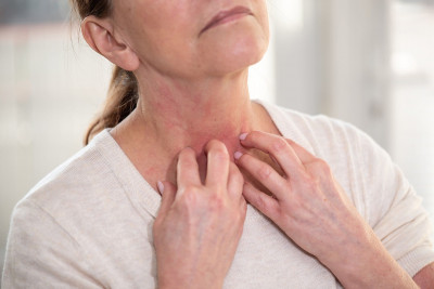 Gatal-Gatal akibat Menopause? Anda Bisa Lakukan Ini
